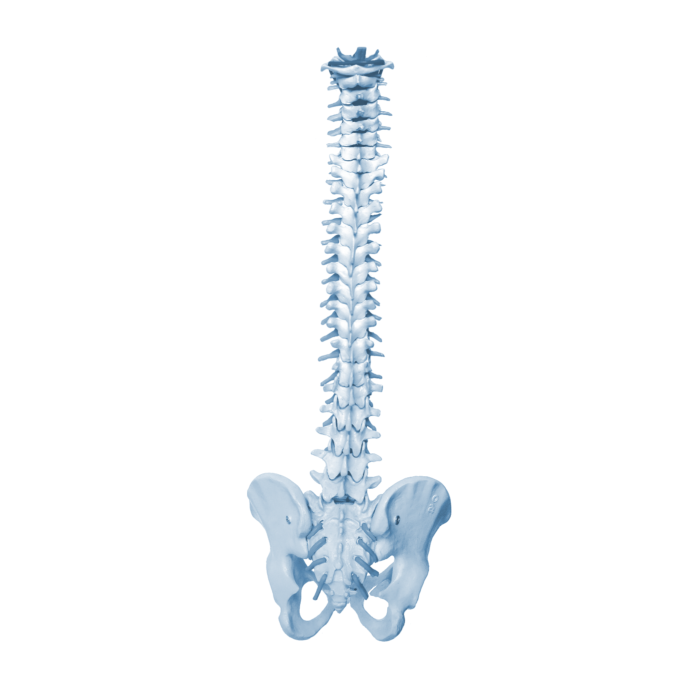 dolor de columna